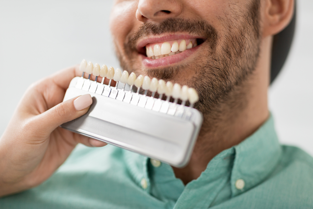 A Guide to Porcelain Veneers and Cosmetic Dentistry